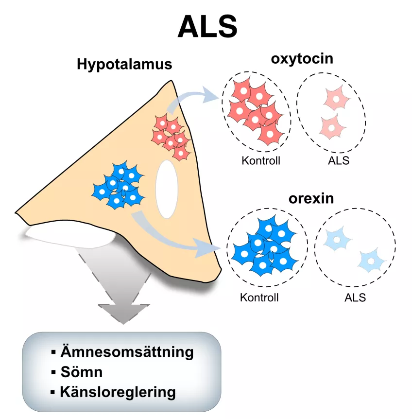 I den publicerade studien visar forskarna för första gången att antalet nervceller som tillverkar ämnena orexin och oxytocin är minskade i hjärnvävnad från ALS patienter jämfört med kontroller. Dessa ämnen reglerar ämnesomsättning, sömn och känslor från hjärnans hormoncentral hypotalamus, och kan vara delaktiga i sjukdomsförloppet vid ALS. illustrayion.